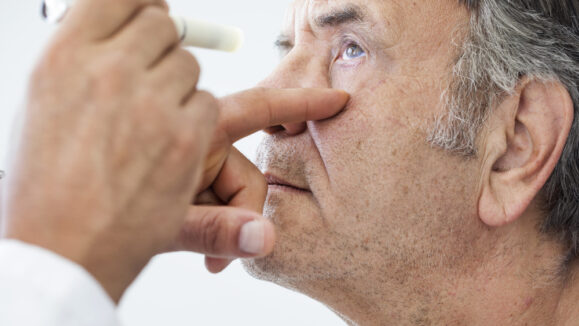 Elderly,Man,Examined,By,An,Ophthalmologist