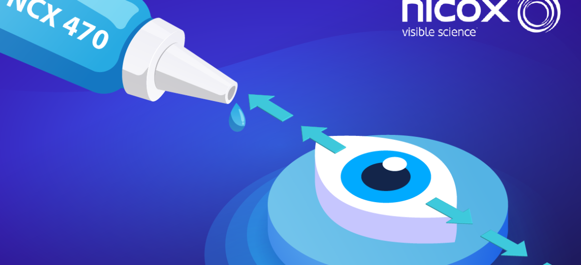 Nicox Whistler Phase 3b Glaucoma Trial Results 01