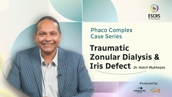 [TFG] Phaco Complex video #2
